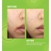 Лікувальний крем для проблемної шкіри Dr.Jart+ Ctrl-A Teatreement Moisturizer 50мл